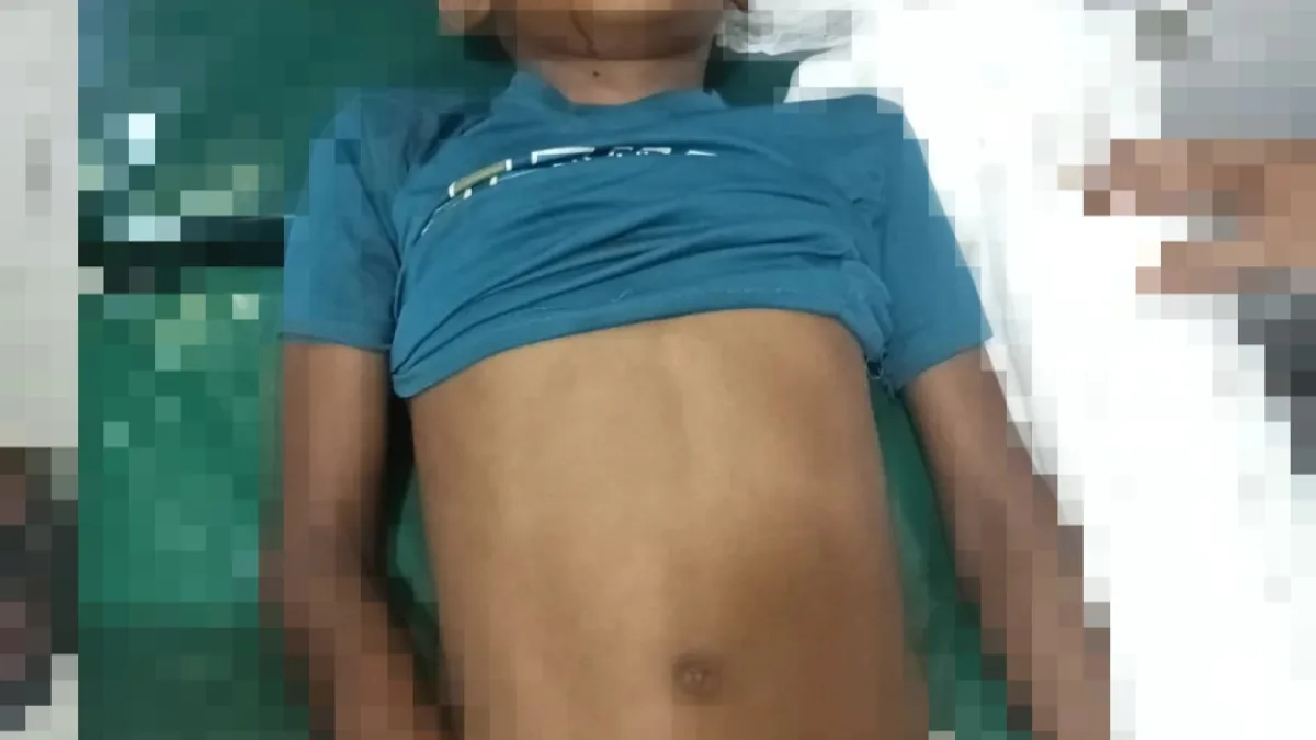 সুনামগঞ্জের গৌরারংয়ে অটোরিকশার ধাক্কায় এক স্কুল শিক্ষার্থীর মৃত্যু